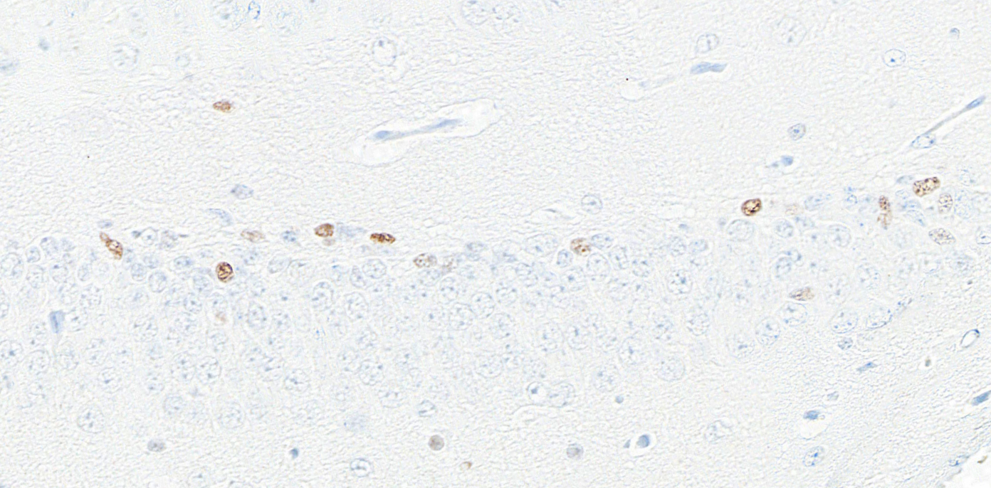 Immunohistochemistry (Formalin/PFA-fixed paraffin-embedded sections) - Anti-ASCL1/MASH1 antibody [BLR164J] - BSA free (AB314100), expandable thumbnail