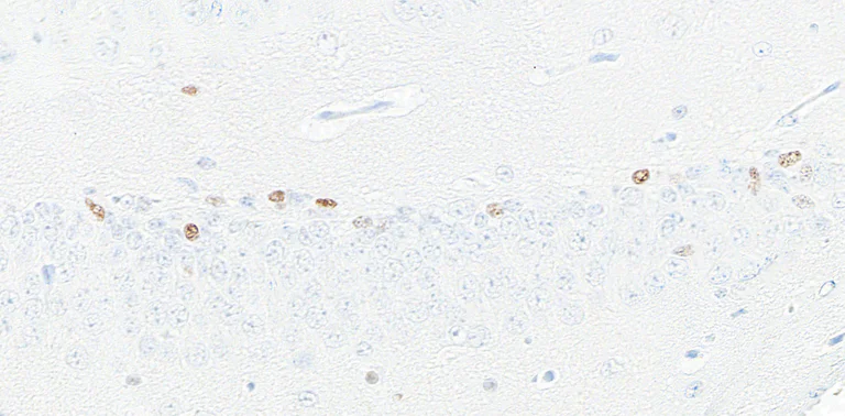 Immunohistochemistry (Formalin/PFA-fixed paraffin-embedded sections) - Anti-ASCL1/MASH1 antibody [BLR164J] - BSA free (AB314100)