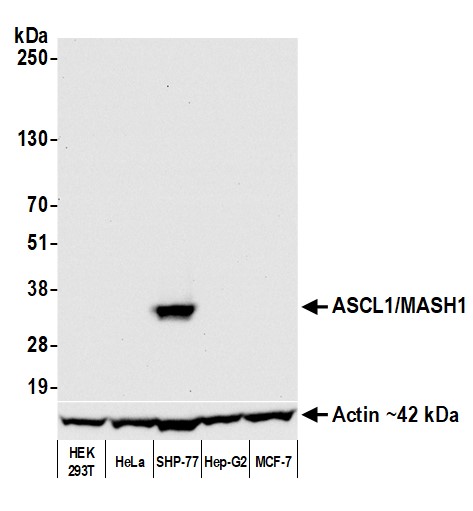 Western blot - Anti-ASCL1/MASH1 antibody [BLR164J] - BSA free (ab314100), expandable thumbnail