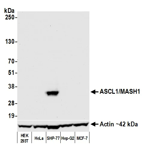 Western blot - Anti-ASCL1/MASH1 antibody [BLR164J] - BSA free (AB314100)