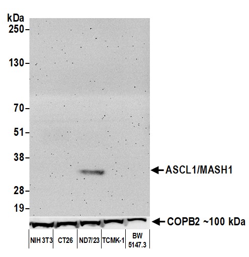 Western blot - Anti-ASCL1/MASH1 antibody [BLR164J] - BSA free (ab314100), expandable thumbnail