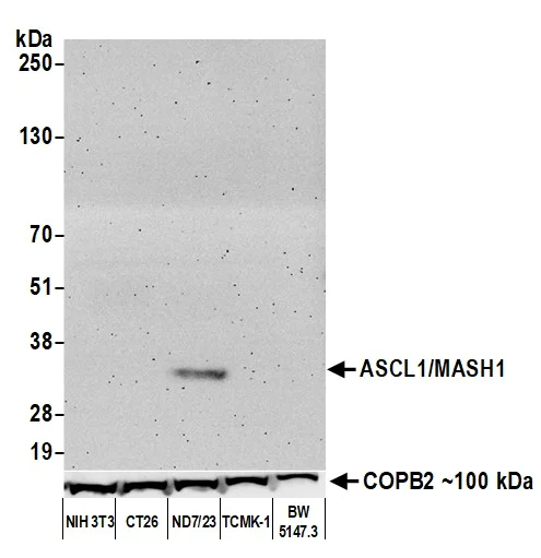 Western blot - Anti-ASCL1/MASH1 antibody [BLR164J] - BSA free (AB314100)