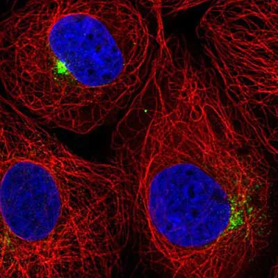 Immunocytochemistry/ Immunofluorescence - Anti-ASCT-1 antibody (AB204348)