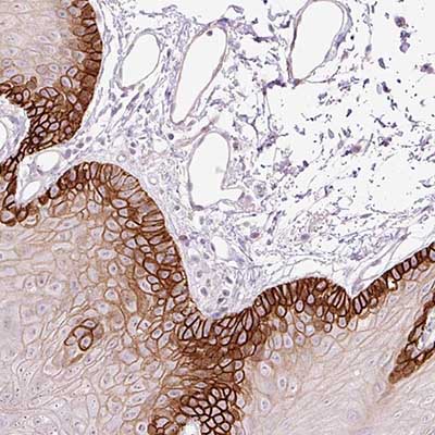 Immunohistochemistry (Formalin/PFA-fixed paraffin-embedded sections) - Anti-ASCT-1 antibody (AB204348), expandable thumbnail