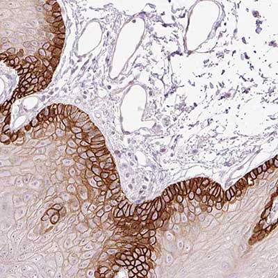 Immunohistochemistry (Formalin/PFA-fixed paraffin-embedded sections) - Anti-ASCT-1 antibody (AB204348)