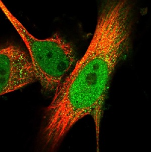 Immunocytochemistry/ Immunofluorescence - Anti-Asef2 antibody (AB122627), expandable thumbnail