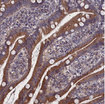Immunohistochemistry (Formalin/PFA-fixed paraffin-embedded sections) - Anti-Asef2 antibody (AB122627), expandable thumbnail