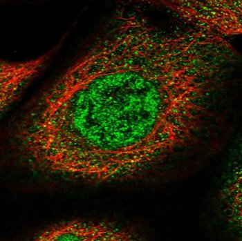 Immunocytochemistry/ Immunofluorescence - Anti-Asef2 antibody (AB122701), expandable thumbnail