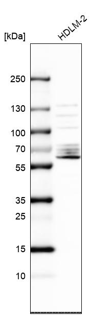 Western blot - Anti-Asef2 antibody (AB122701), expandable thumbnail