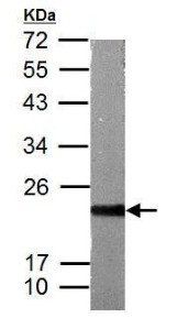Western blot - Anti-ASF1b antibody (AB183651), expandable thumbnail