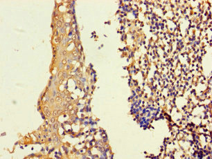 Immunohistochemistry (Formalin/PFA-fixed paraffin-embedded sections) - Anti-ASF1b antibody (AB235358), expandable thumbnail
