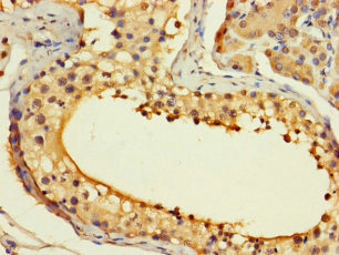 Immunohistochemistry (Formalin/PFA-fixed paraffin-embedded sections) - Anti-ASF1b antibody (AB235358), expandable thumbnail