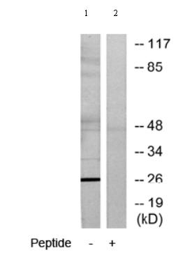Western blot - Anti-ASF1b antibody (AB70126), expandable thumbnail