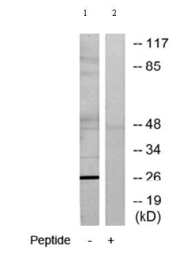 Western blot - Anti-ASF1b antibody (AB70126)