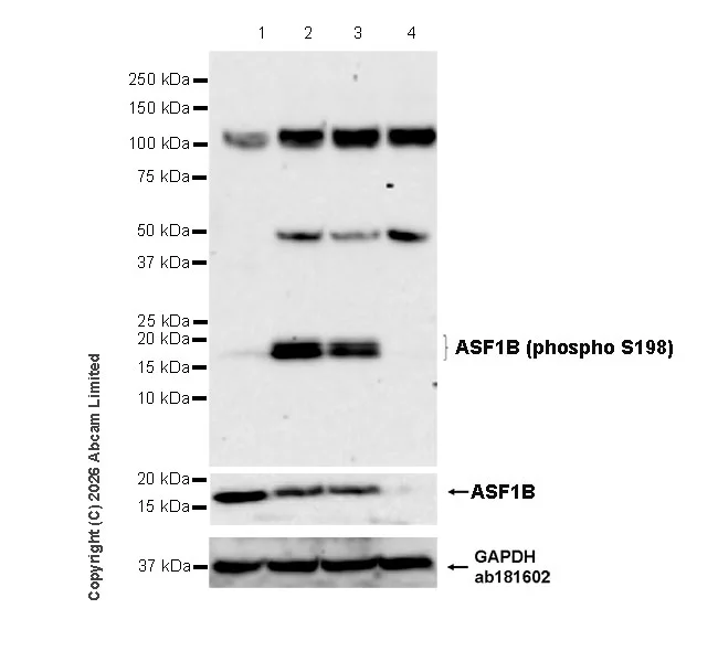 Western blot - Anti-ASF1B (phospho S198) antibody [EPR28822-77] (AB325649)