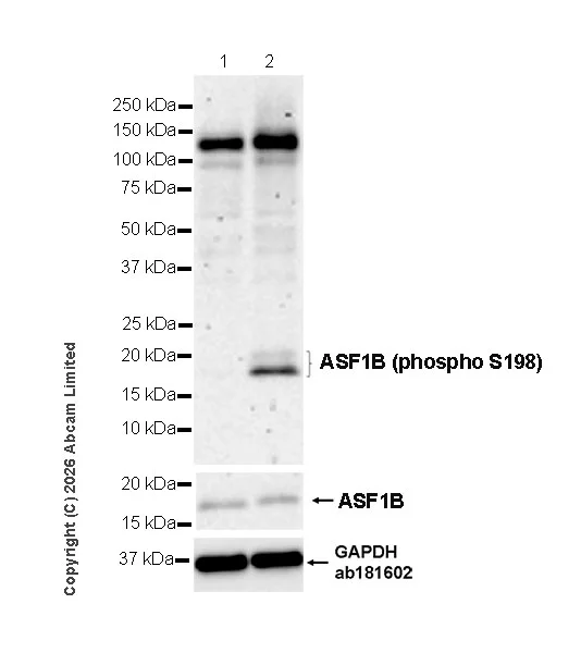 Western blot - Anti-ASF1B (phospho S198) antibody [EPR28822-77] (AB325649)