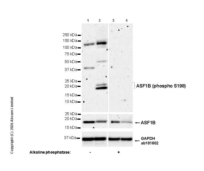 Western blot - Anti-ASF1B (phospho S198) antibody [EPR28822-77] (AB325649)