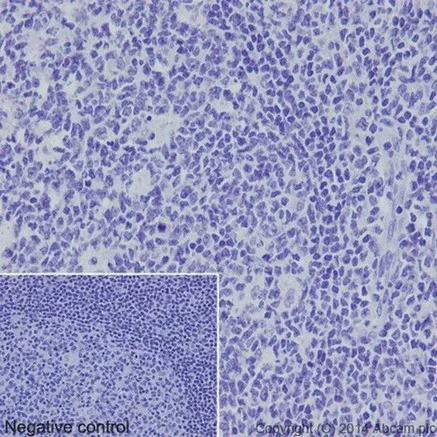 Immunohistochemistry (Formalin/PFA-fixed paraffin-embedded sections) - Anti-ASGR2 antibody [EPR16974] (AB197032)