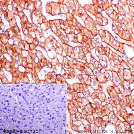 Immunohistochemistry (Formalin/PFA-fixed paraffin-embedded sections) - Anti-ASGR2 antibody [EPR16974] (AB197032)