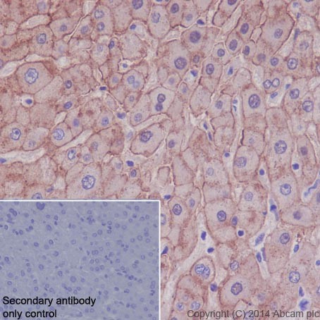 Immunohistochemistry (Formalin/PFA-fixed paraffin-embedded sections) - Anti-ASGR2 antibody [EPR16975] (AB200196)
