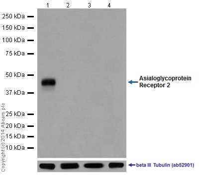 Anti-ASGR2 antibody [EPR16975]