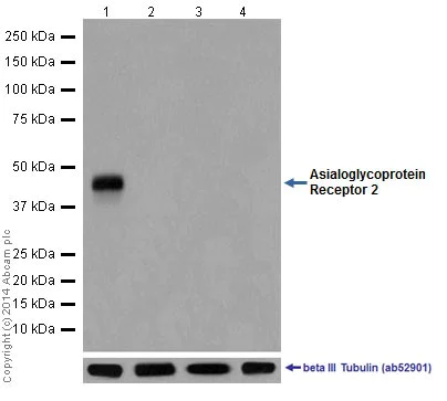 Western blot - Anti-ASGR2 antibody [EPR16975] (AB200196)
