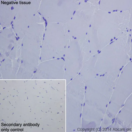 Immunohistochemistry (Formalin/PFA-fixed paraffin-embedded sections) - Anti-ASGR2 antibody [EPR16975] - BSA and Azide free (AB216521)