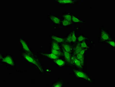 Immunocytochemistry/ Immunofluorescence - Anti-ASH1L antibody (AB234745)