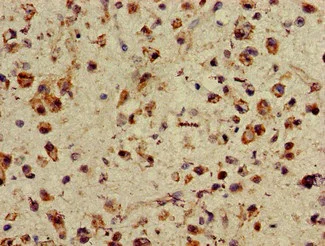 Immunohistochemistry (Formalin/PFA-fixed paraffin-embedded sections) - Anti-ASH1L antibody (AB234745)