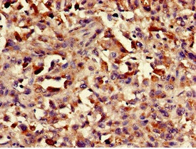 Immunohistochemistry (Formalin/PFA-fixed paraffin-embedded sections) - Anti-ASH1L antibody (AB234745)