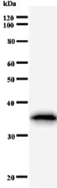 Western blot - Anti-ASH1L antibody [ASH5H03] (AB50981)