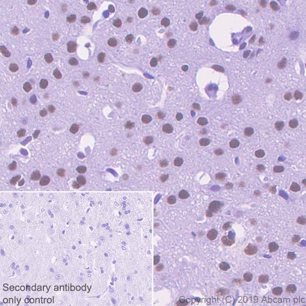 Immunohistochemistry (Formalin/PFA-fixed paraffin-embedded sections) - Anti-ASH2L antibody [EPR13107(B)] - BSA and Azide free (AB240191), expandable thumbnail