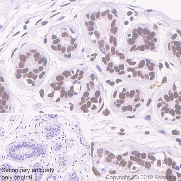 Immunohistochemistry (Formalin/PFA-fixed paraffin-embedded sections) - Anti-ASH2L antibody [EPR13107(B)] - BSA and Azide free (AB240191), expandable thumbnail