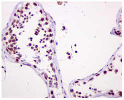 Immunohistochemistry (Formalin/PFA-fixed paraffin-embedded sections) - Anti-ASH2L antibody [EPR13107(B)] - BSA and Azide free (ab240191), expandable thumbnail