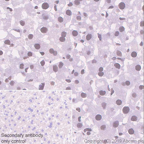 Immunohistochemistry (Formalin/PFA-fixed paraffin-embedded sections) - Anti-ASH2L antibody [EPR13107(B)] - Nuclear Marker (AB176334)