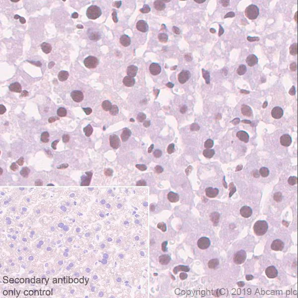 Immunohistochemistry (Formalin/PFA-fixed paraffin-embedded sections) - Anti-ASH2L antibody [EPR13107(B)] - Nuclear Marker (AB176334)