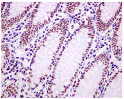Immunohistochemistry (Formalin/PFA-fixed paraffin-embedded sections) - Anti-ASH2L antibody [EPR13107(B)] - Nuclear Marker (AB176334)