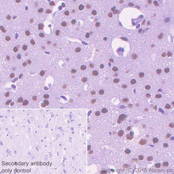 Immunohistochemistry (Formalin/PFA-fixed paraffin-embedded sections) - Anti-ASH2L antibody [EPR13107(B)] - Nuclear Marker (AB176334)