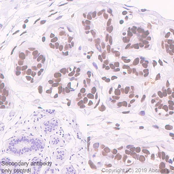 Immunohistochemistry (Formalin/PFA-fixed paraffin-embedded sections) - Anti-ASH2L antibody [EPR13107(B)] - Nuclear Marker (AB176334)