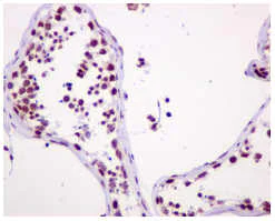 Immunohistochemistry (Formalin/PFA-fixed paraffin-embedded sections) - Anti-ASH2L antibody [EPR13107(B)] - Nuclear Marker (AB176334)