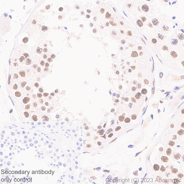Immunohistochemistry (Formalin/PFA-fixed paraffin-embedded sections) - Anti-ASH2L antibody [EPR28054-48] - BSA and Azide free (AB314129)