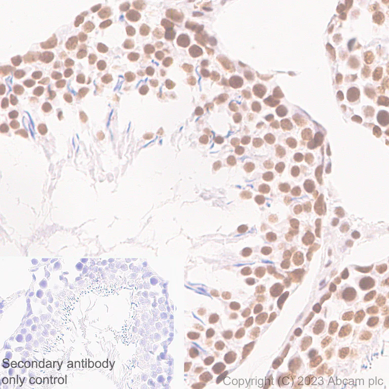 Immunohistochemistry (Formalin/PFA-fixed paraffin-embedded sections) - Anti-ASH2L antibody [EPR28054-48] - BSA and Azide free (AB314129)