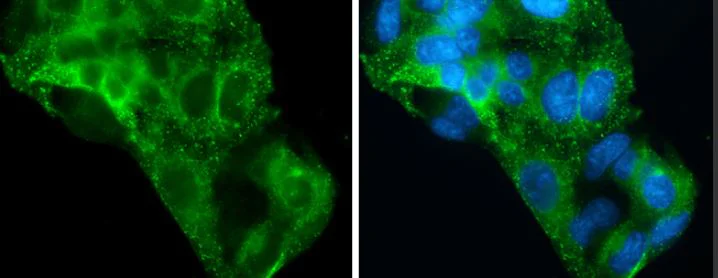 Immunocytochemistry/ Immunofluorescence - Anti-Asialoglycoprotein Receptor 1/HL-1 antibody (AB127896)