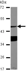 Western blot - Anti-Asialoglycoprotein Receptor 1/HL-1 antibody (AB127896)