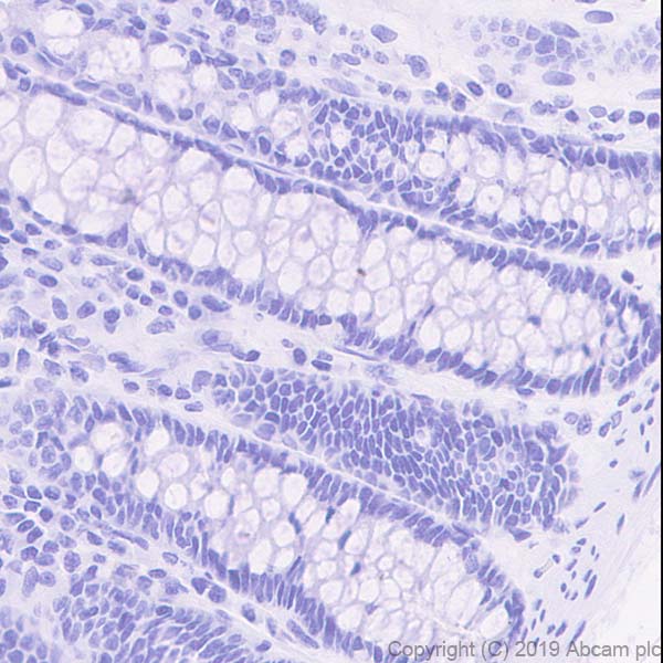 Immunohistochemistry (Formalin/PFA-fixed paraffin-embedded sections) - Anti-Asialoglycoprotein Receptor 1/HL-1 antibody [EPR22639-68] (ab254261), expandable thumbnail