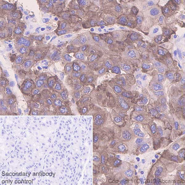 Immunohistochemistry (Formalin/PFA-fixed paraffin-embedded sections) - Anti-Asialoglycoprotein Receptor 1/HL-1 antibody [EPR22639-68] (AB254261), expandable thumbnail