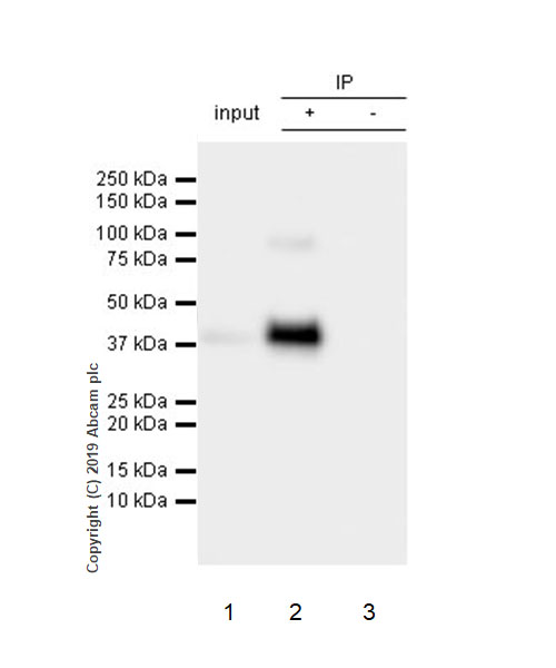 Immunoprecipitation - Anti-Asialoglycoprotein Receptor 1/HL-1 antibody [EPR22639-68] (AB254261), expandable thumbnail