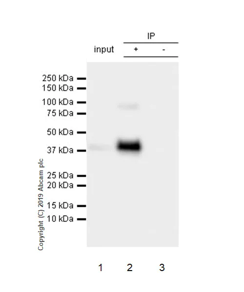 Immunoprecipitation - Anti-Asialoglycoprotein Receptor 1/HL-1 antibody [EPR22639-68] (AB254261)