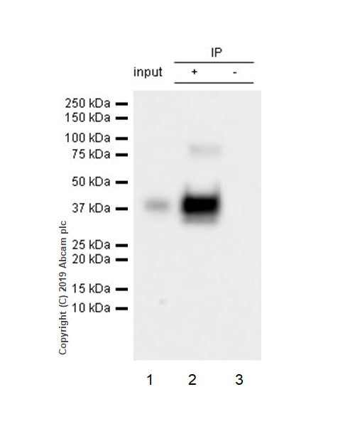 Immunoprecipitation - Anti-Asialoglycoprotein Receptor 1/HL-1 antibody [EPR22639-68] (ab254261), expandable thumbnail