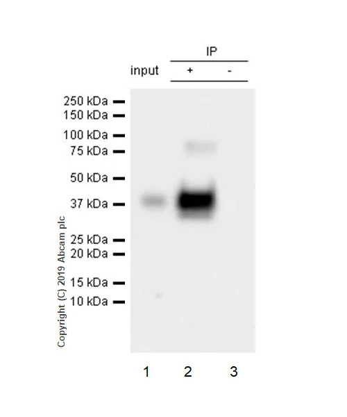 Immunoprecipitation - Anti-Asialoglycoprotein Receptor 1/HL-1 antibody [EPR22639-68] (AB254261)